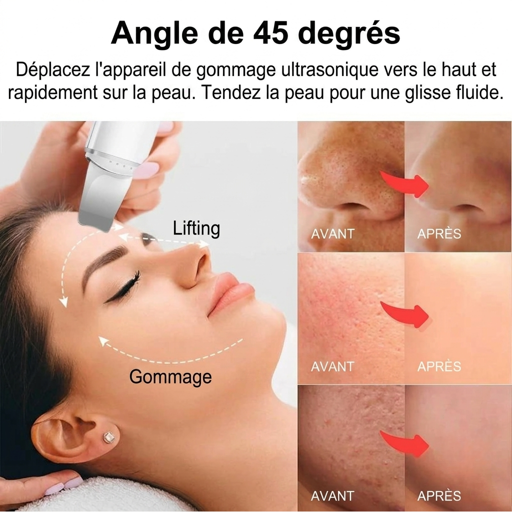 Kelya Limpiador Facial Ultrasónico Profesional – Limpieza y Lifting Facial